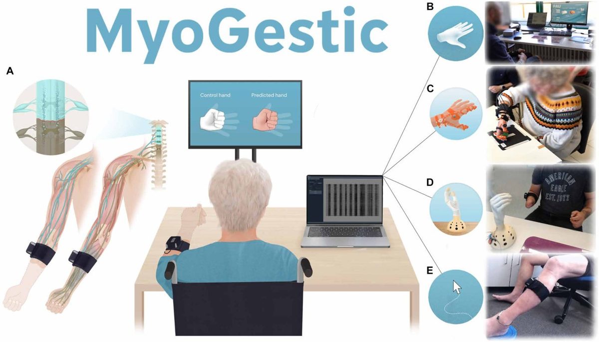 A participant wearing the EMG bracelet controls a virtual hand, an orthosis, a prosthesis and a cursor